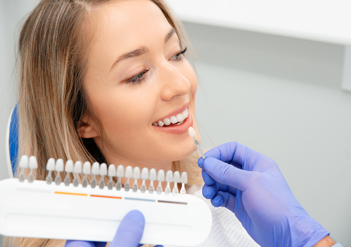 EMAX Veneers